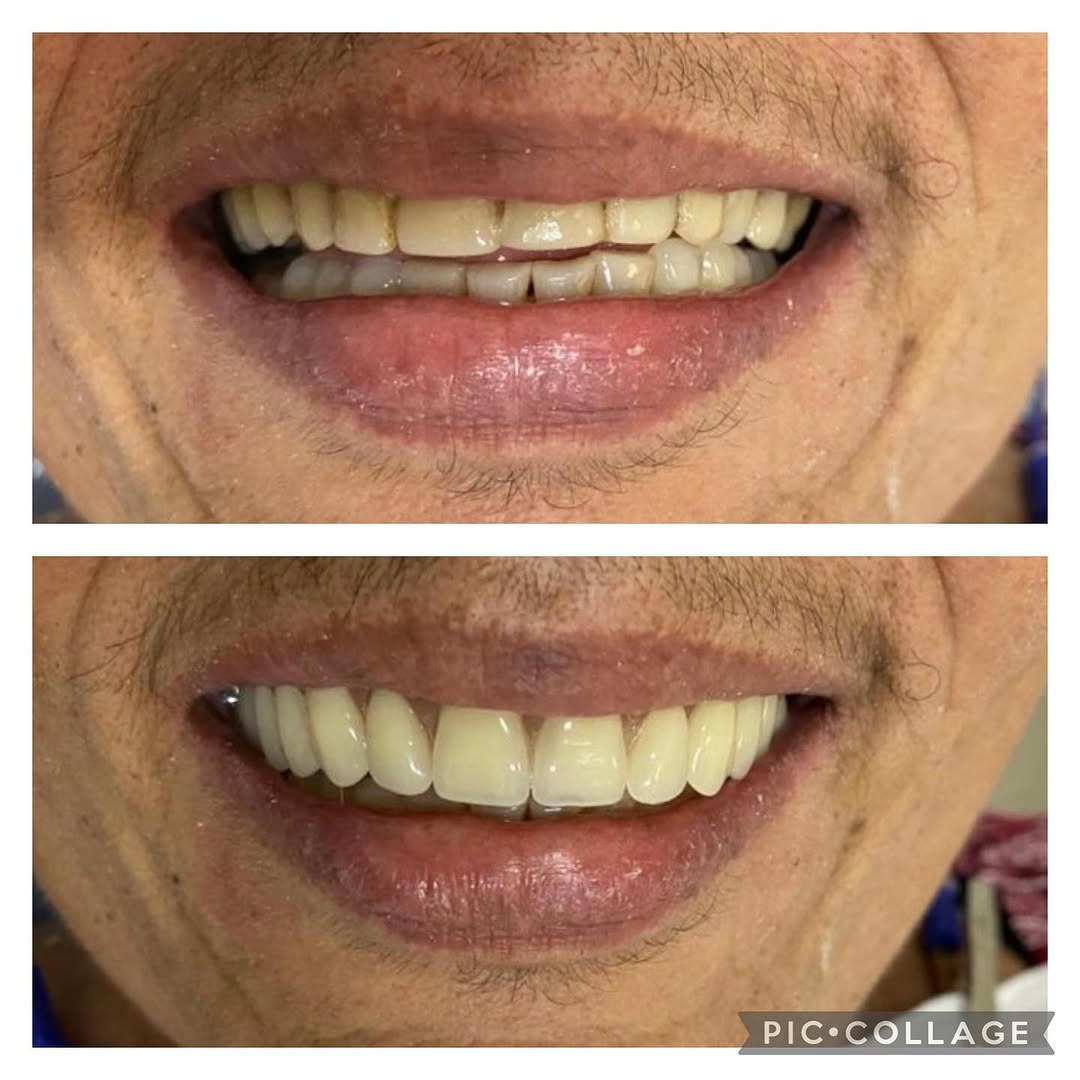 Prótese Dentária OBE